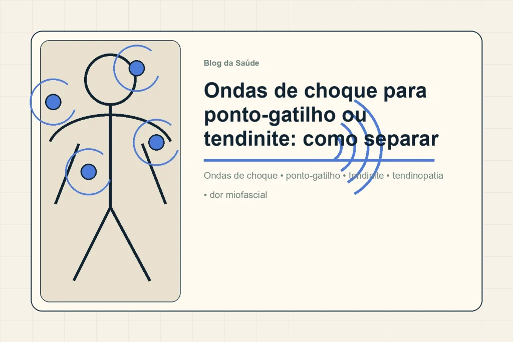 Ilustração compara ponto-gatilho muscular e tendão como alvos diferentes para ondas de choque.