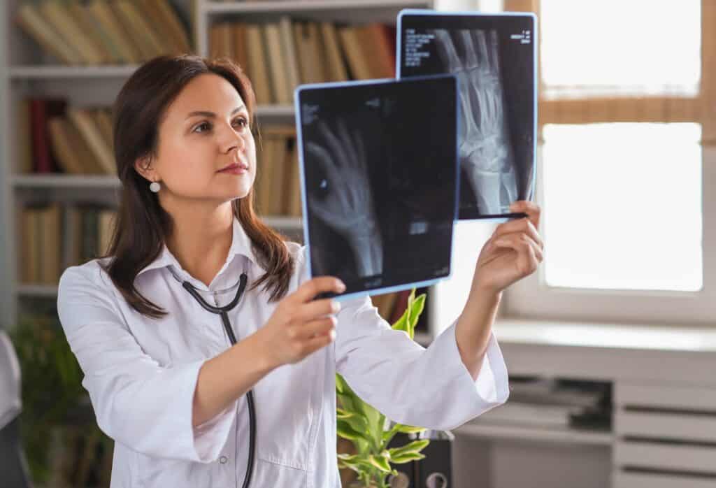 Osteoporose - O que é? Causas, Sintomas e Tratamentos 1 osteoporose fragilidade