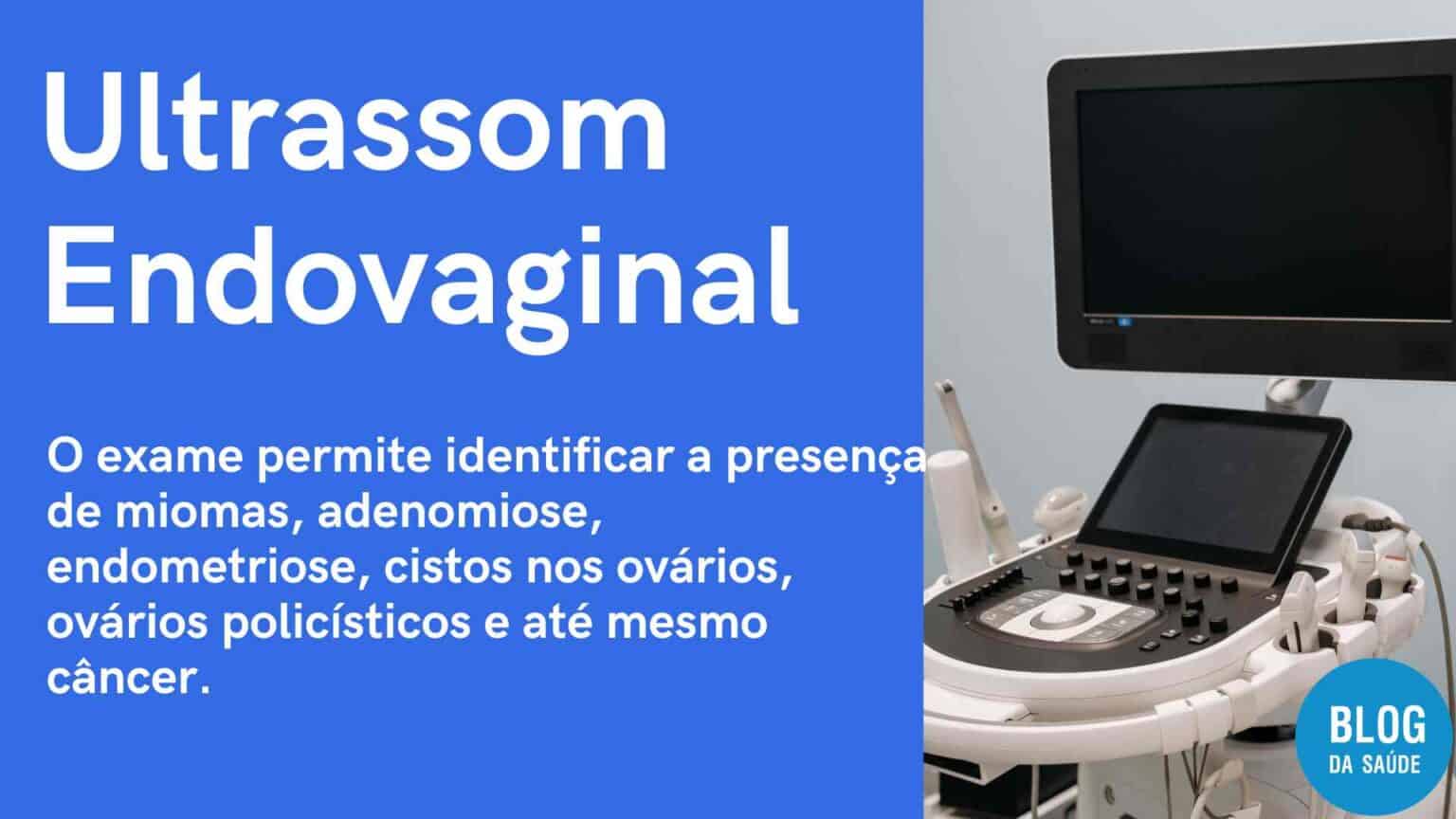 Ultrassom Endovaginal Transvaginal Para Que Serve Blog Da Saúde