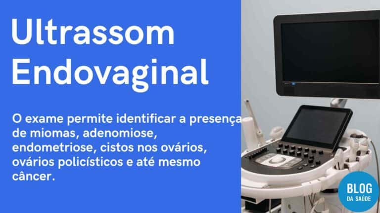 Ultrassom Endovaginal Transvaginal Para Que Serve Blog Da Sa De