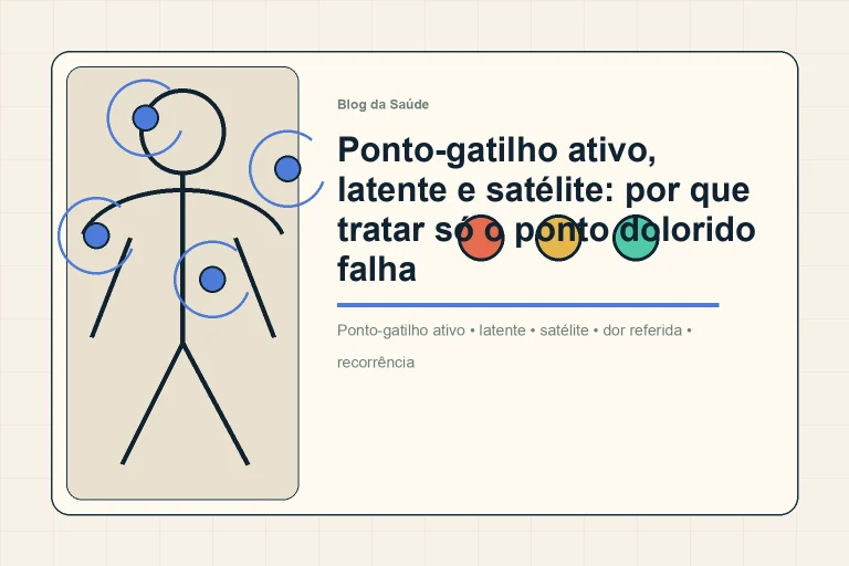 Ilustração mostra pontos-gatilho ativo, latente e satélite em mapa muscular simples.