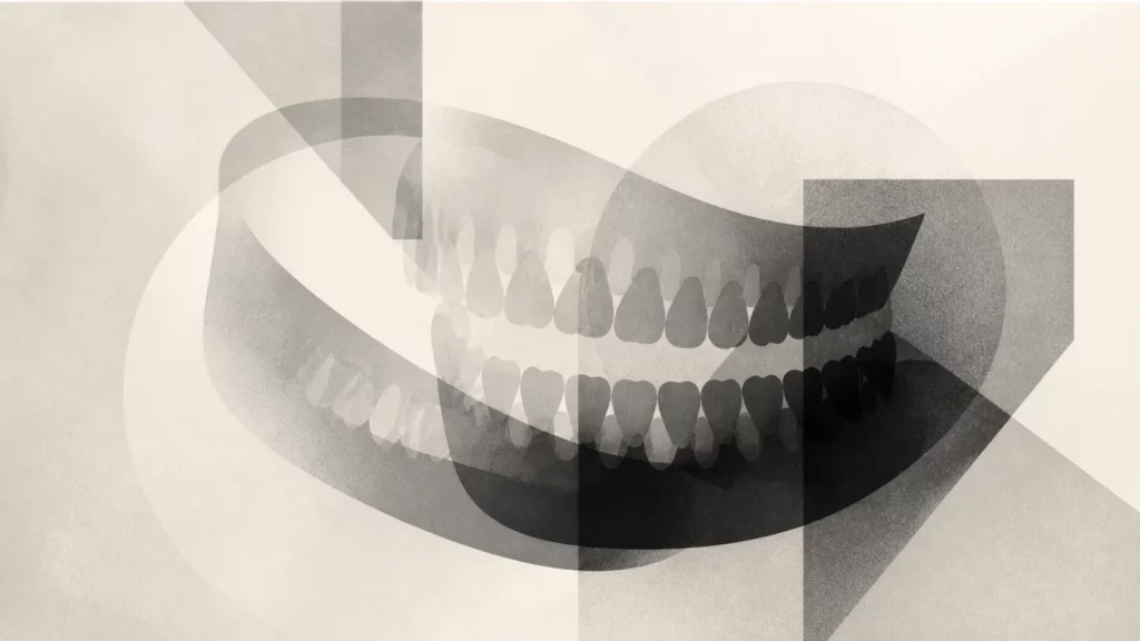 Ilustração editorial abstrata em tons de cinza sobre raio x dentes