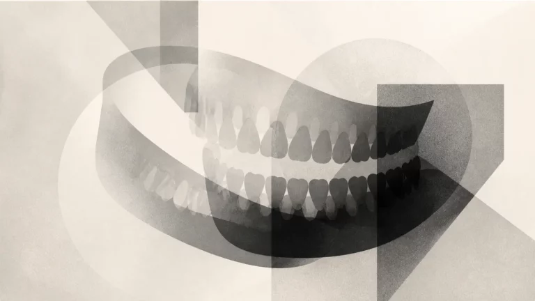 Ilustração editorial abstrata em tons de cinza sobre raio x dentes