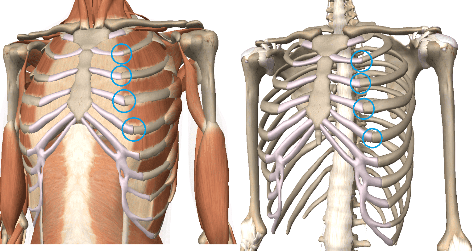 Sindrome Di Tietze Sintomi Cause Diagnosi Terapia E Cure Naturali Sexiz Pix