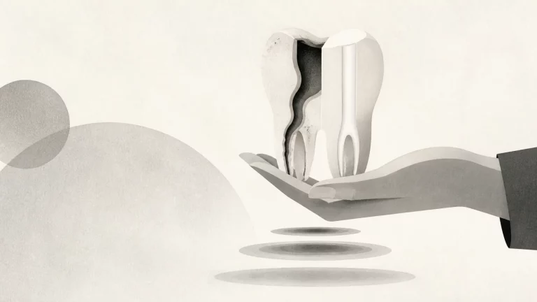 Ilustração editorial abstrata em tons de cinza sobre canal nos dentes dói