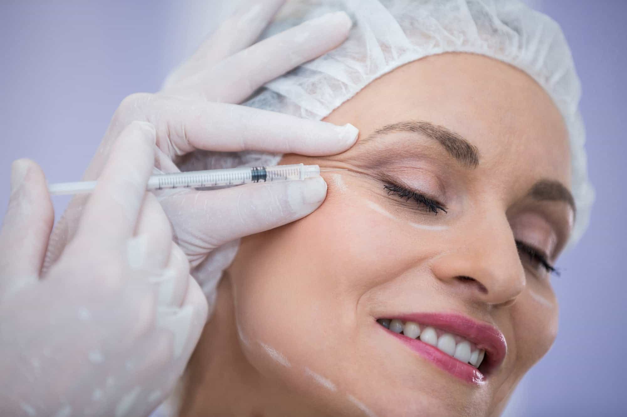 woman with marked face receiving botox injection